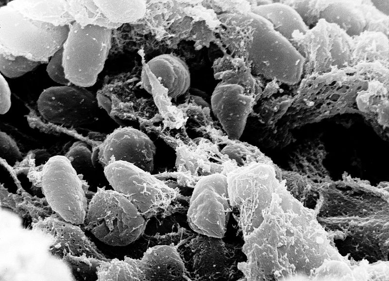 Scanning electron micrograph depicting a mass of Yersinia pestis bacteria