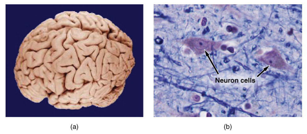 Photo A shows an entire human brain which has a lumpy and deeply striated appearance. Photo B is a micrograph of neural tissue. It contains two roughly diamond-shaped cells with dark nuclei. The cells are embedded in a light colored tissue containing smaller cells and fiber strands.