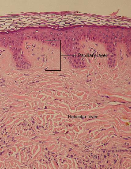 This micrograph shows layers of skin in a cross section. The papillary layer of the dermis extends between the downward fingers of the darkly stained epidermis. The papillary layer appears finer than the reticular layer, consisting of smaller, densely-packed fibers. The reticular layer is three times thicker than the papillary layer and contains larger, thicker fibers. The fibers seem more loosely packed than those of the papillary layer, with some separated by empty spaces. Both layers of the dermis contain cells with darkly stained nuclei.