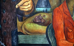 Rivera, Man Controller of the Universe, detail with radiation treatment for breast cancer