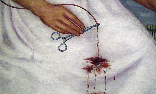 Frida Kahlo, detail with Hemostat, The Two Fridas (Las dos Fridas), 1939, oil on canvas, 67-11/16 x 67-11/16&Prime; (Museo de Arte Moderno, Mexico City) (photo: Dave Cooksey, CC: BY-NC-SA 2.0)