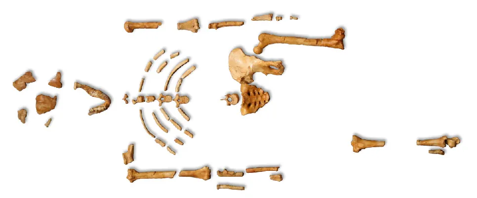 A picture of unconnected pieces of a skeleton are shown on a white background. The bones are pale brown to dark brown in color and in broken pieces. From the top to the bottom, these bones shown are: five pieces of the skull, the lower jaw with teeth on the left side, one piece of the left clavicle, five pieces of the spine, six pieces of each arm, nine pieces of ribs from the left side, eight pieces of ribs from the right side, one piece of the lower spine, the tailbone, the right piece of the hip, the top of the right leg, one piece of the top of the left leg, the left knee joint, and a small piece of the left leg.