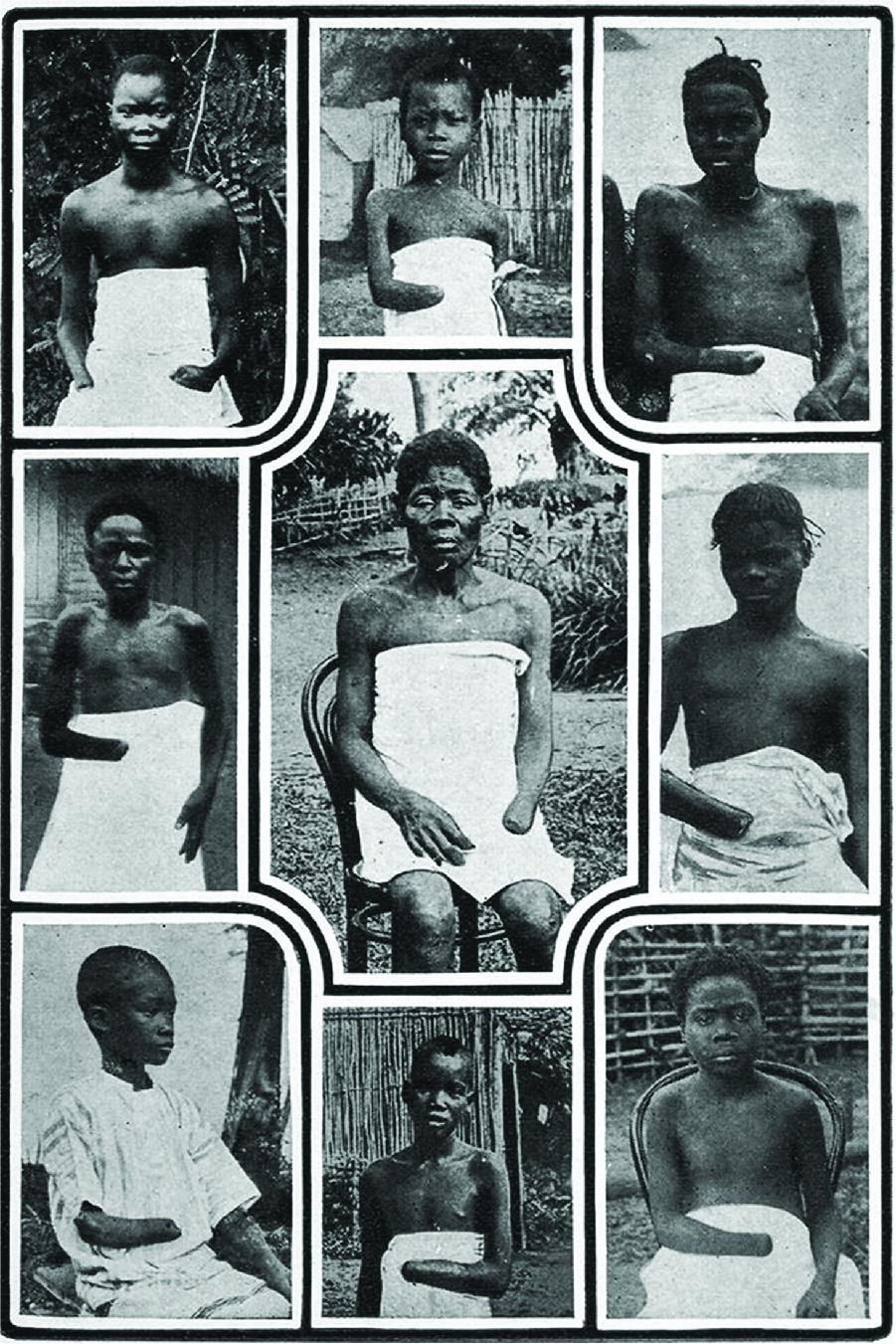 A photograph shows nine African American children and adults, in three rows of three. Eight of them wear only a cloth, either across their waist or higher on their chest, while one in the left bottom corner wears a while striped shirt. All of them are shown with one hand cut off. The backgrounds of the pictures show fields, straw huts, and wooden fences.