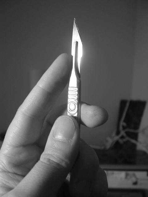 Photo of a hand holding a sharp scalpel.