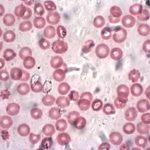 magnified blood cells