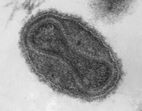 Smallpox_virus_virions_TEM_PHIL_1849-1024x800.jpg
