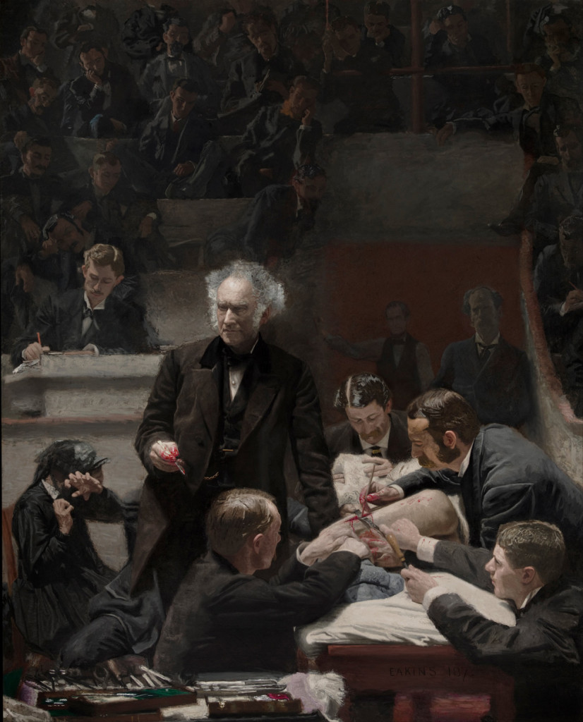 A portrait of Doctor Samuel D. Gross giving a lecture at a live surgery. The only part of the patient visible is his or her leg, the rest of the individual is obscured. Three men are operating on the leg while a fourth lifts a blanket, presumably to watch the patient’s face. Doctor Gross stands to the side addressing the audience. Behind Doctor Gross, a man is seated taking notes, and a larger audience sits behind him. A few of the spectators lean over the benches to get a better view. However, one man to Doctor Gross’s right covers his eyes to avoid the gore of the operation. The painting is clinical, showing a minimal but realistic level of blood.
