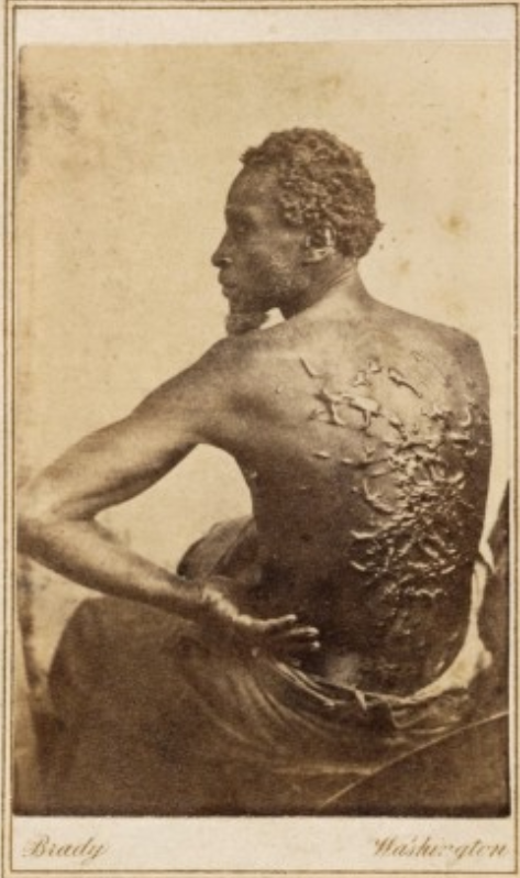 Gordon, the slave pictured here, endured terrible brutality from his master before escaping to Union Army lines in 1863. He would become a soldier and help fight to end the violent system that produced the horrendous scars on his back. Matthew Brady, Gordon, 1863. Wikimedia, http://commons.wikimedia.org/wiki/File:Gordon,_scourged_back,_NPG,_1863.jpg. 
