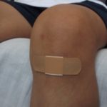 photo of a scraped knee with bandage