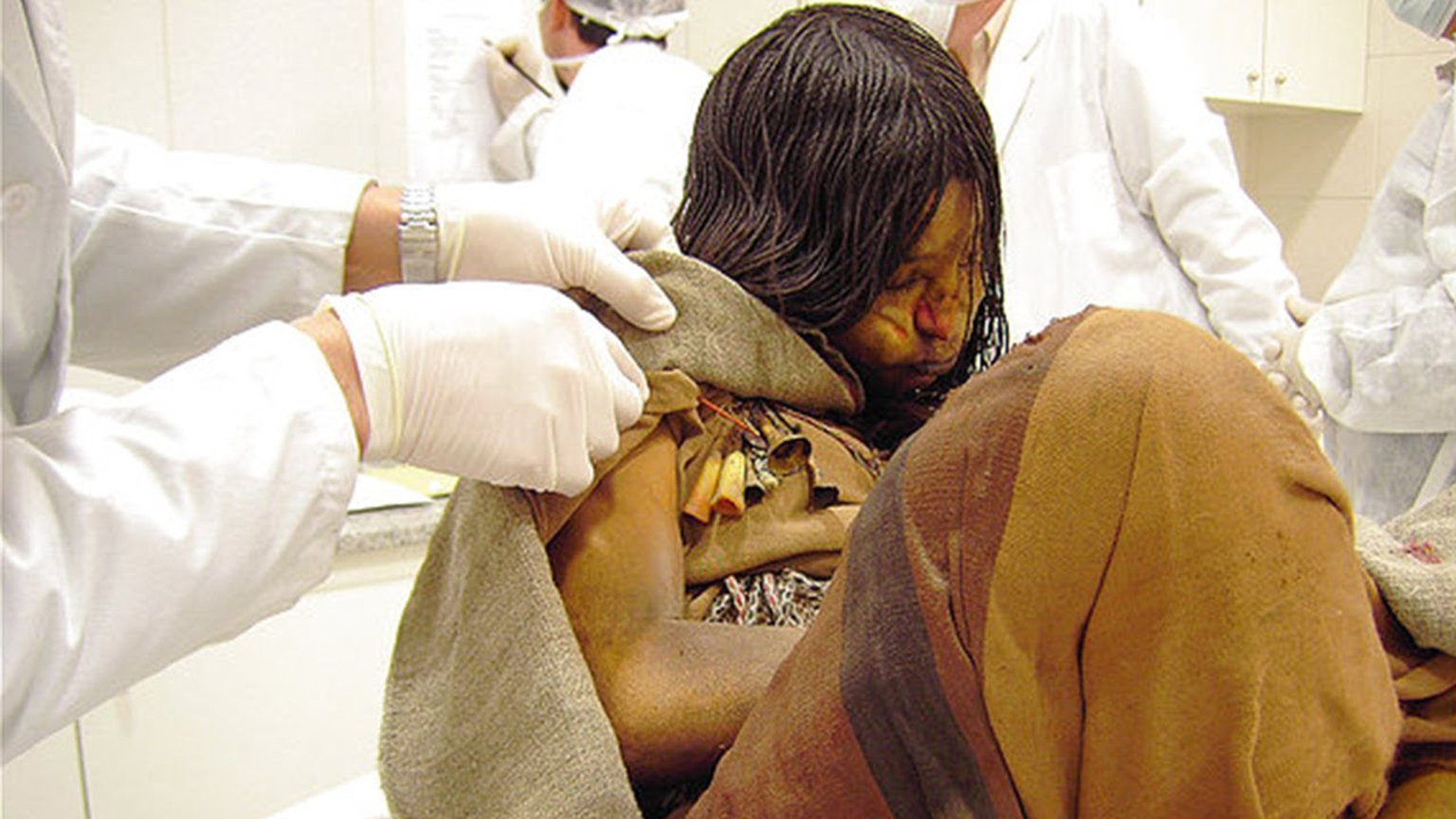Mummified 13 year old girl with her clothes and hair intact