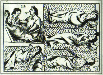 Um desenho mostra cinco representações de uma vítima asteca da varíola. A vítima, que está coberta de manchas, é mostrada dormindo, vomitando e sendo examinada por um curandeiro.