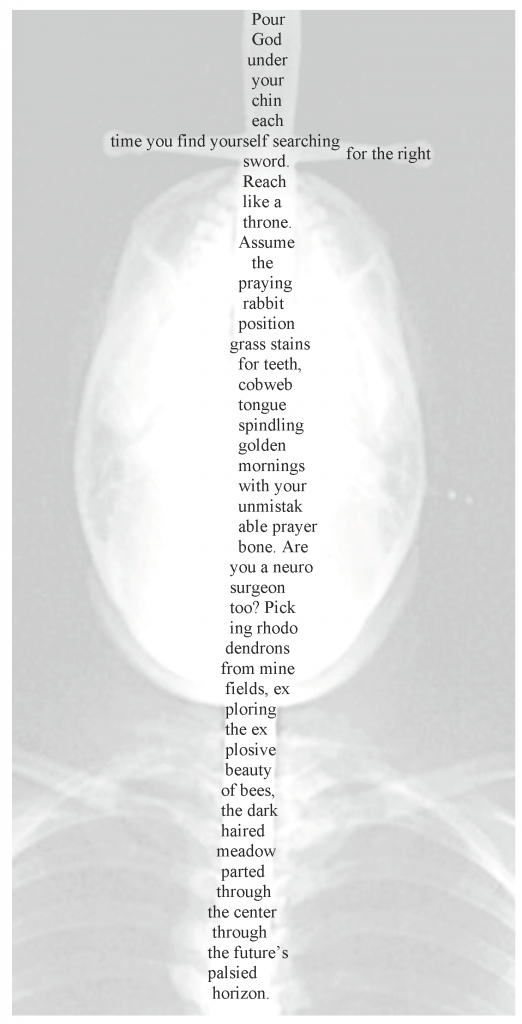 Poem composed on x-ray