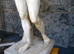 Polykleitos, Doryphoros, detalle con patas