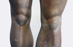 Anavysos Kouros, detail with knees, c. 530 B.C.E.