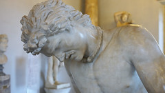 Dying Gaul