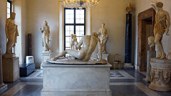 Dying Gaul