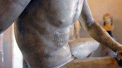 Dying Gaul
