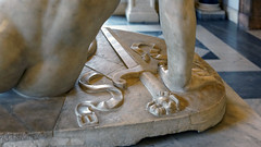 Dying Gaul