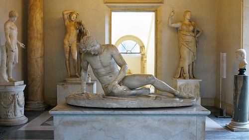 Dying Gaul