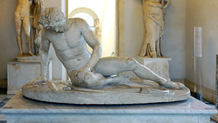 Dying Gaul