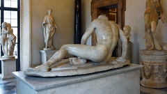 Dying Gaul